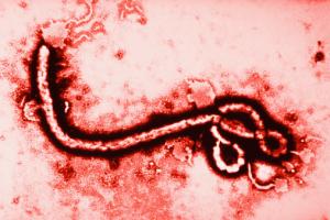 ebola_micrograph_virus-afrique